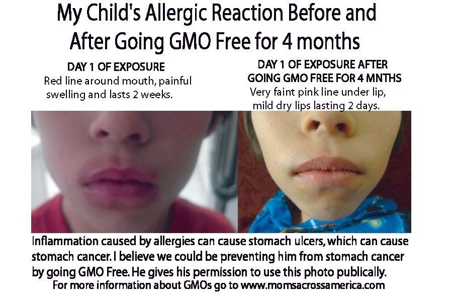 Letter to Oregon and Colorado Voters