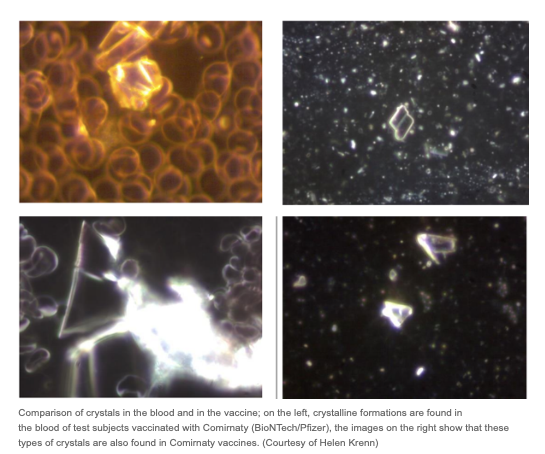 Unusual Toxic Substances Found in COVID Vaccines "Without Exception"