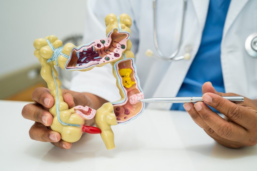 Rising Cases of Colon Cancer Among Younger Kenyans: Why Early Endoscopy Matters