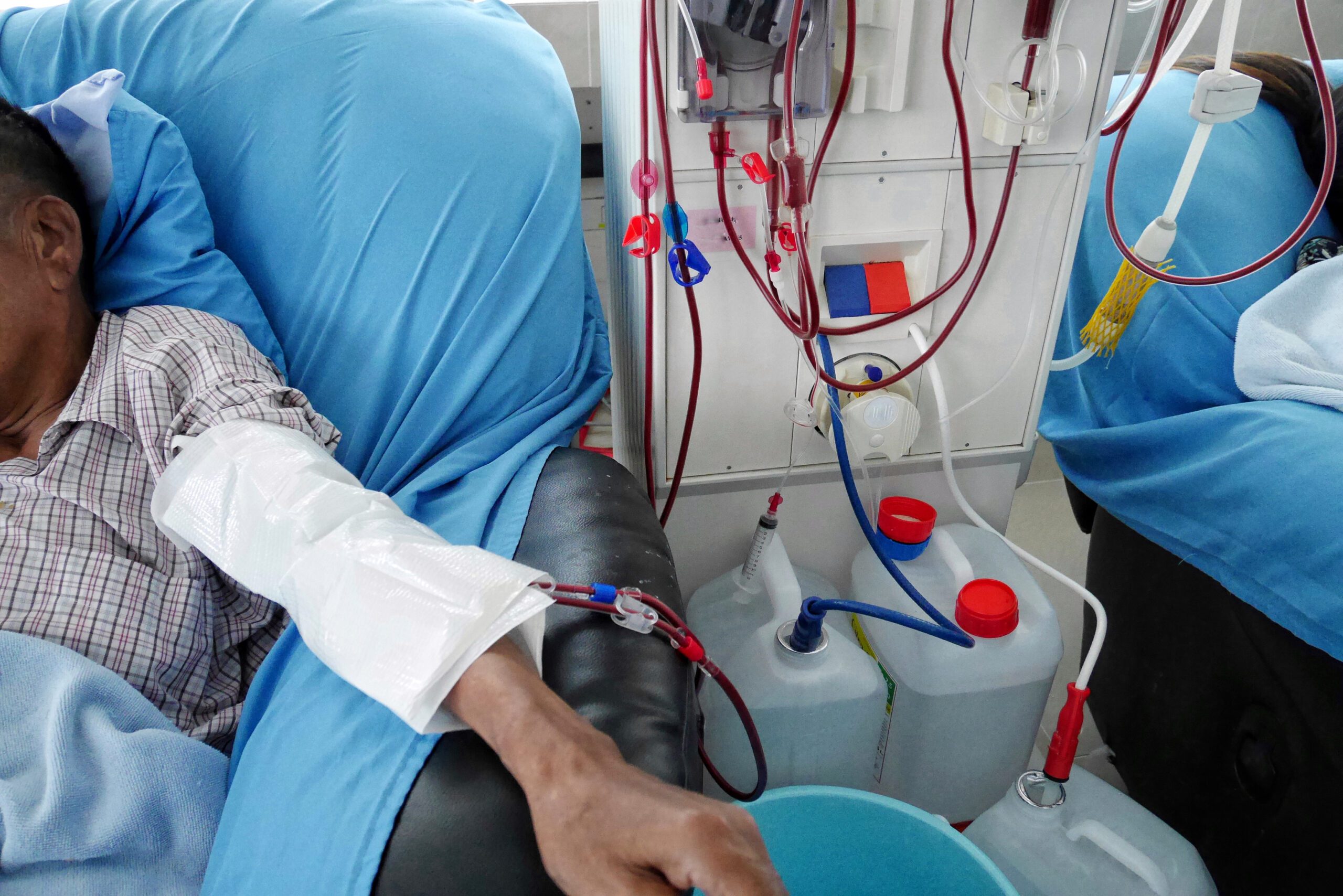 Silent Dialysis Complications You Didn’t Know About: What to Ask Your Doctor