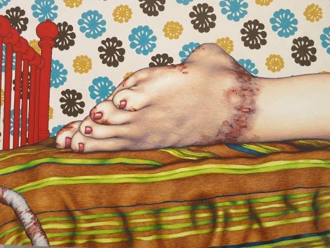 Ashley Hope, Benny and the Jets, 2012. Gouache on panel: a reclining figure’s feet with painted toenails on striped bedding against floral wallpaper.