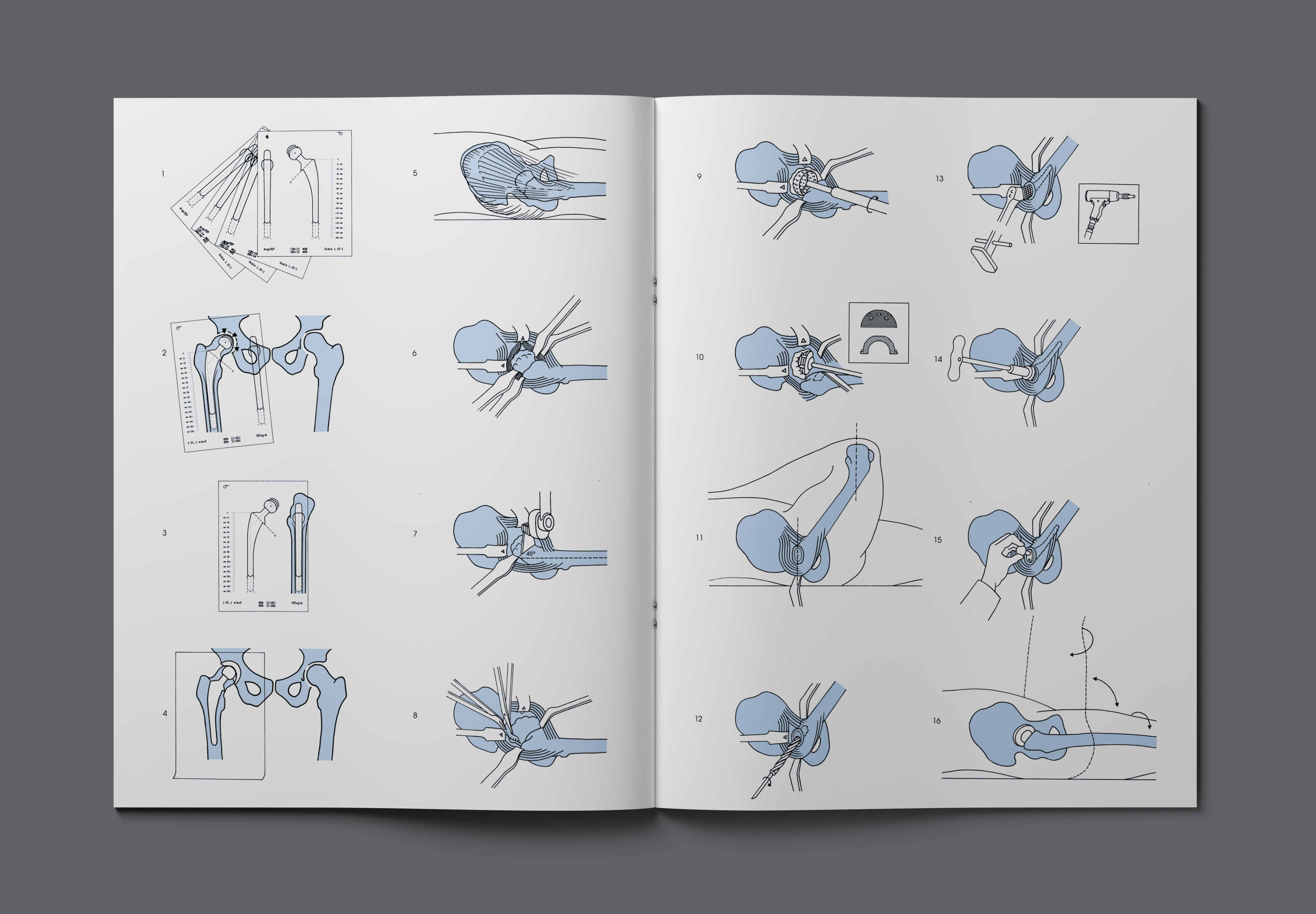 Visual from the Argomedical project — project image 7