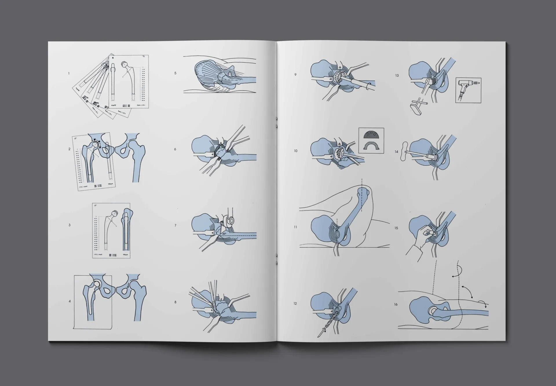 Изображение от проекта Argomedical — project image 7