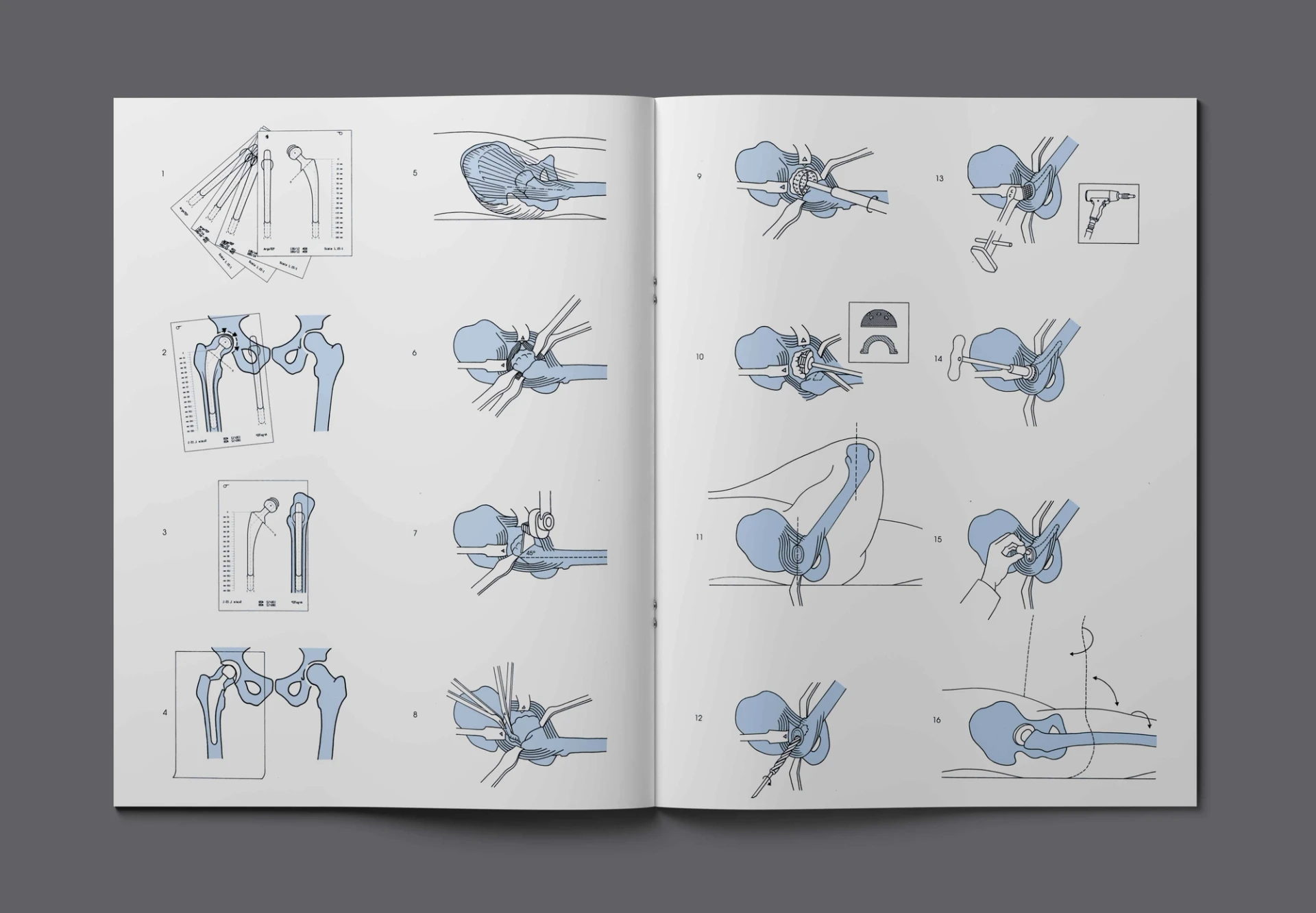 Visual from the Argomedical project — project image 7