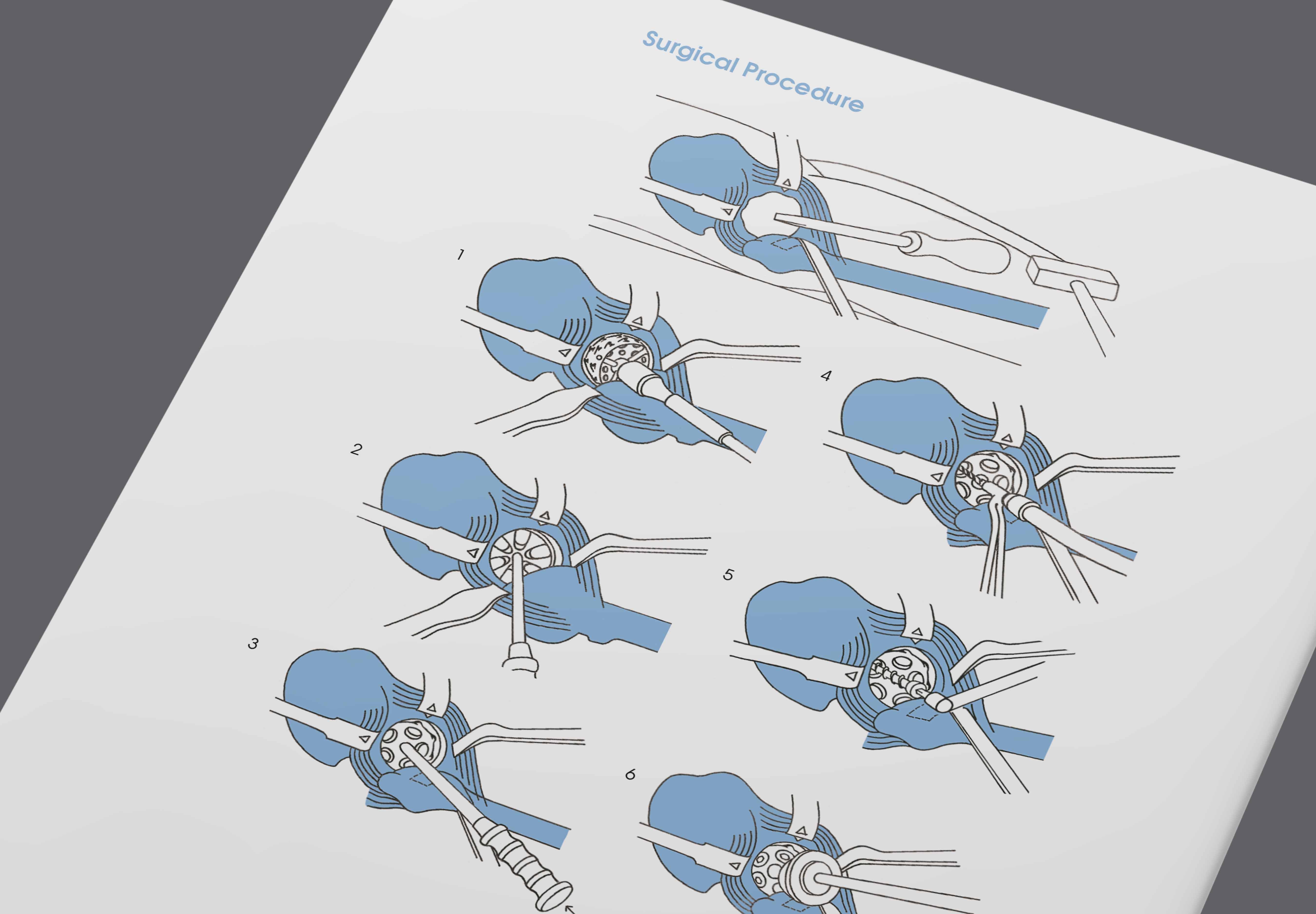 Visual from the Argomedical project — project image 15