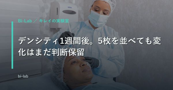 デンシティ1週間後。5枚を並べても変化はまだ判断保留