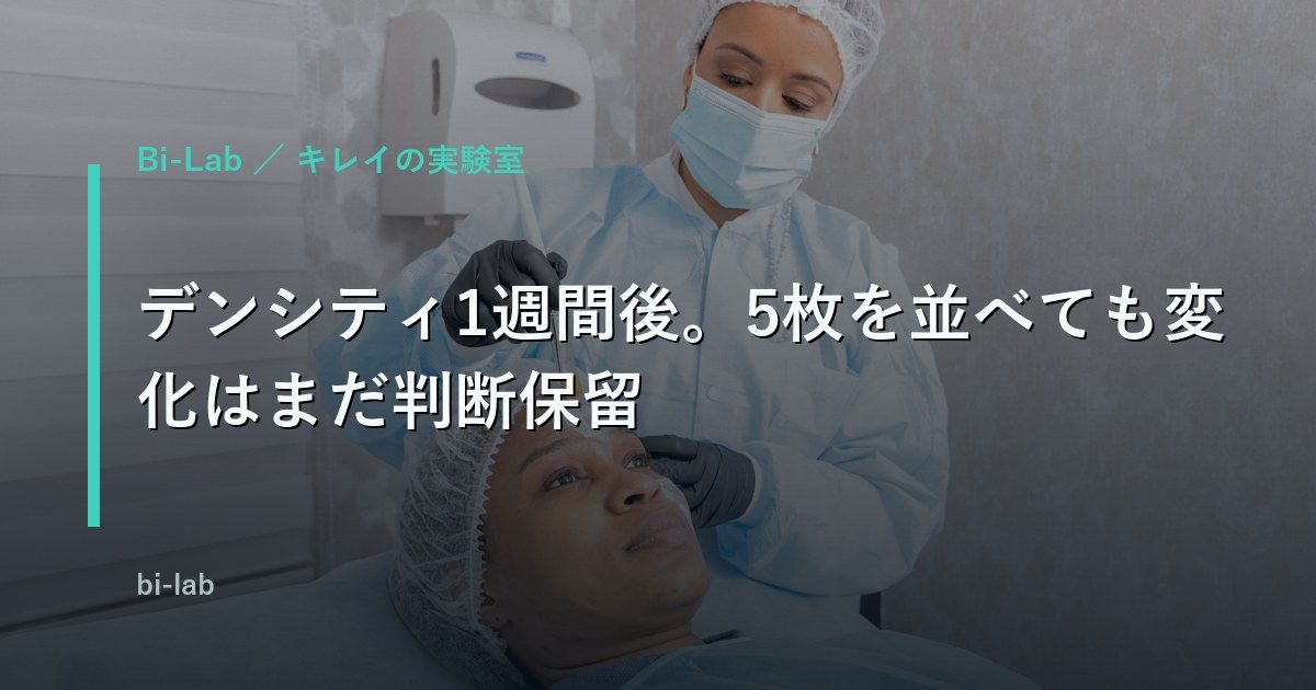デンシティ1週間後。5枚を並べても変化はまだ判断保留