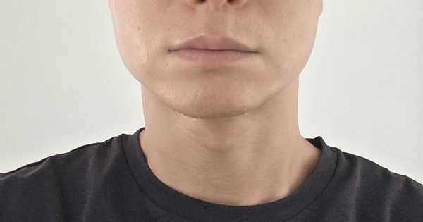 デンシティ1週間後レポート。写真で並べると、なんか変わってきた気がする