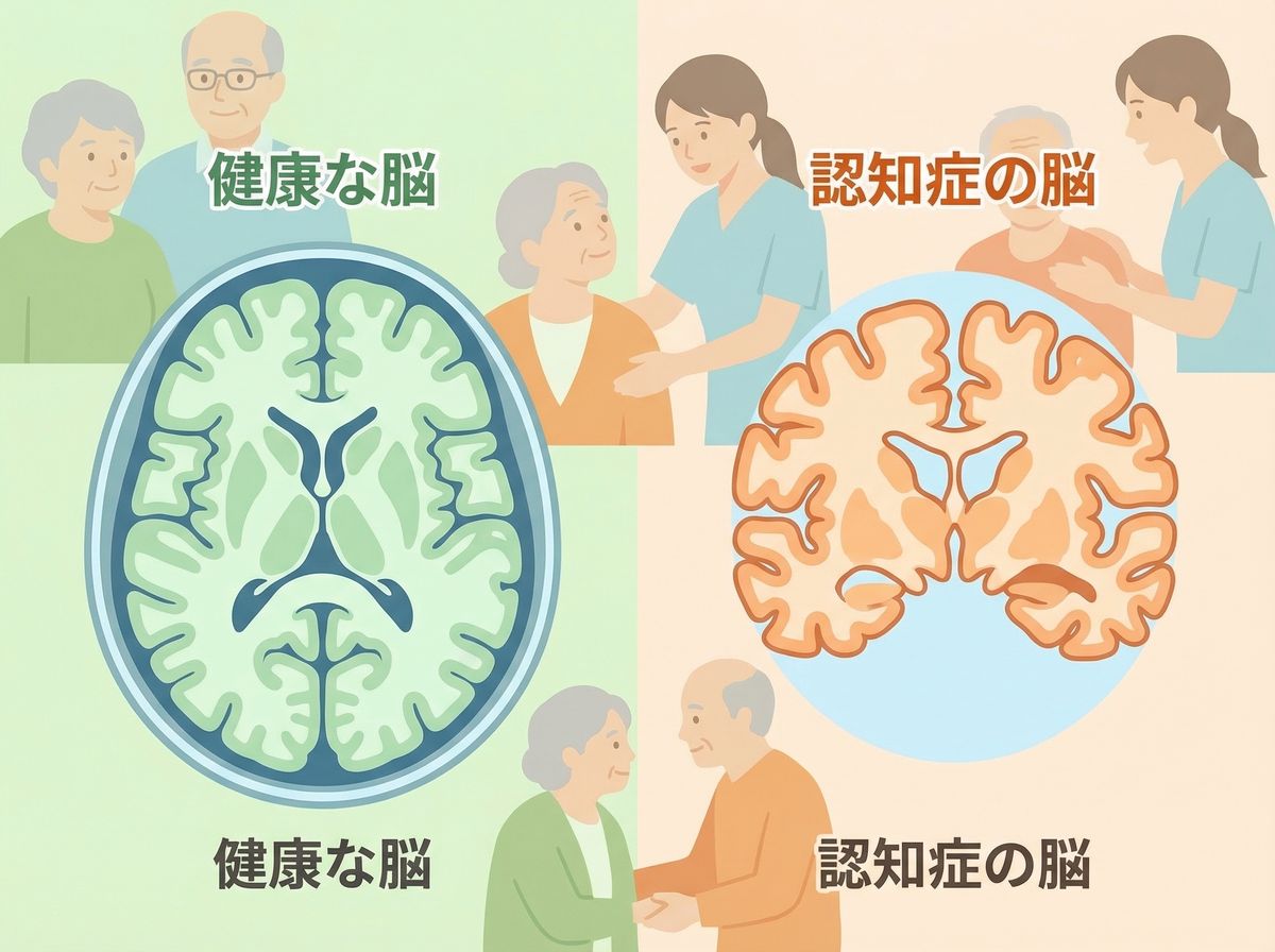 認知症の脳MRI画像