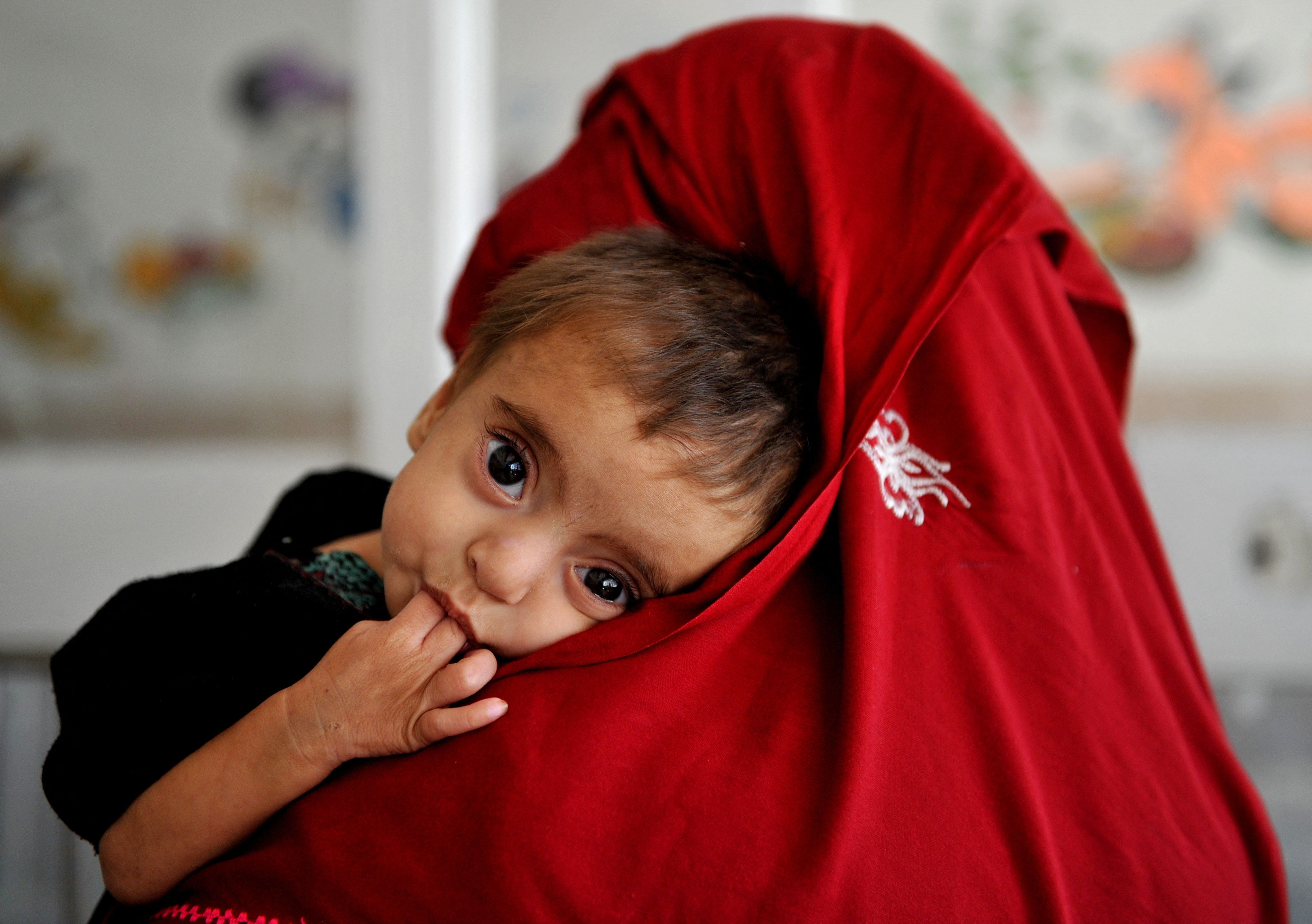 Malnutrition Worsens in 26 Afghan Provinces, OCHA Reports