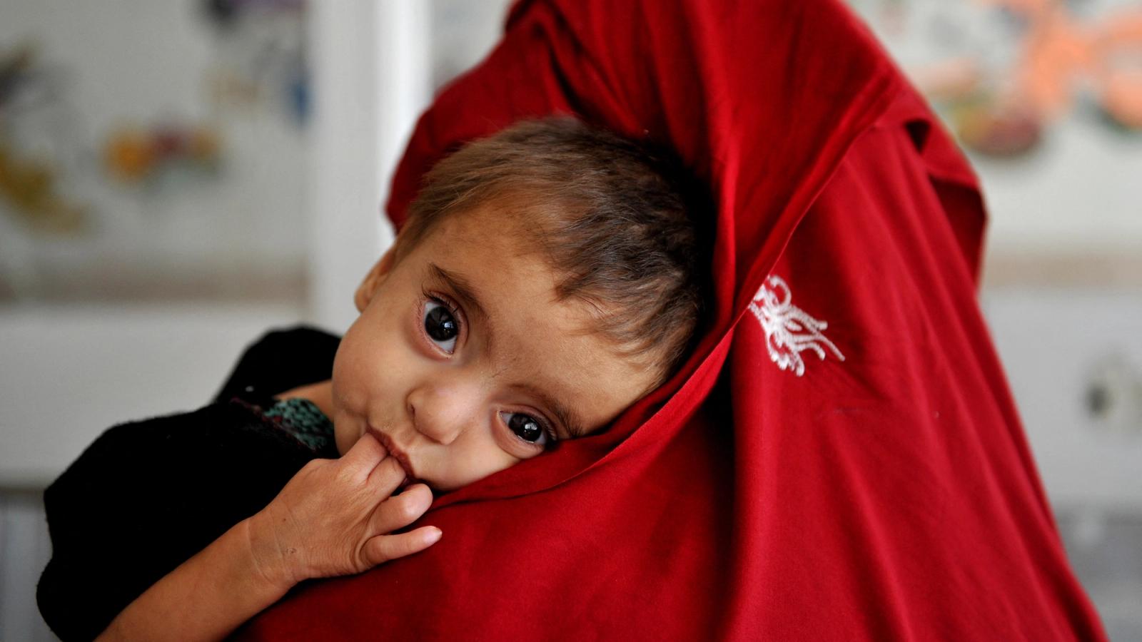 Malnutrition Worsens in 26 Afghan Provinces, OCHA Reports