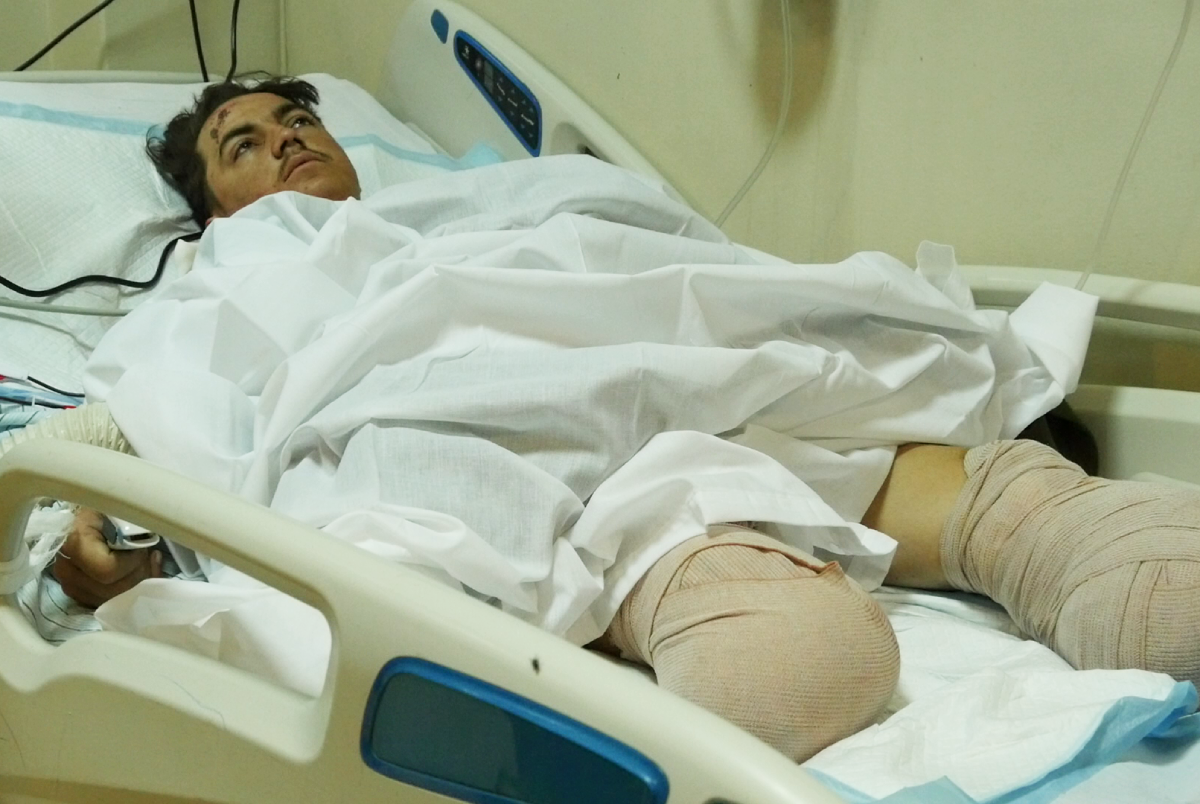More Than 20 Wounded from Paktia Transferred to Kabul Hospital