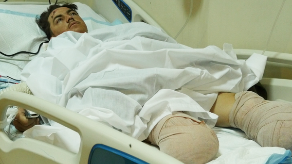 More Than 20 Wounded from Paktia Transferred to Kabul Hospital