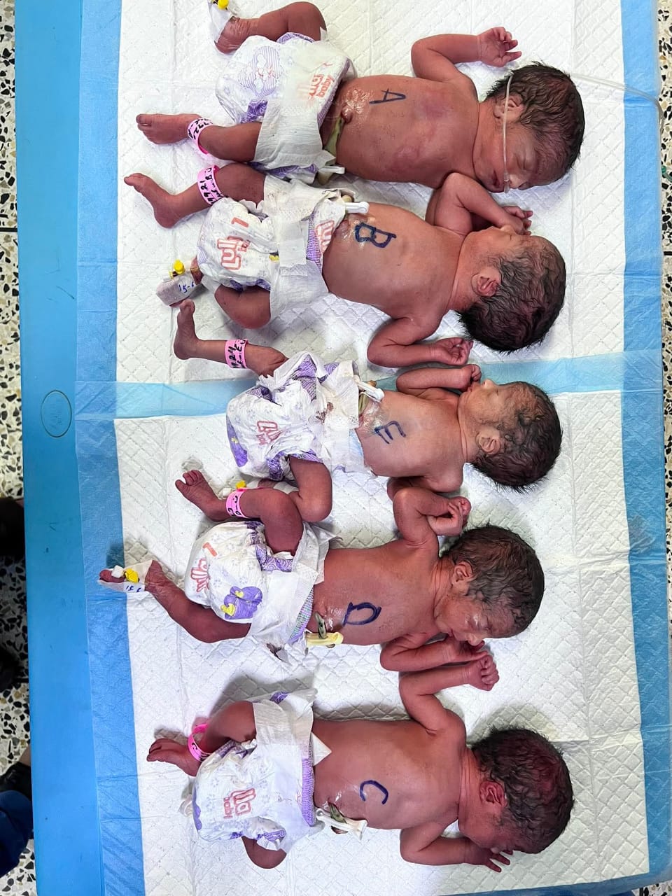 Mother Gives Birth to Quintuplets at Balkh Provincial Hospital