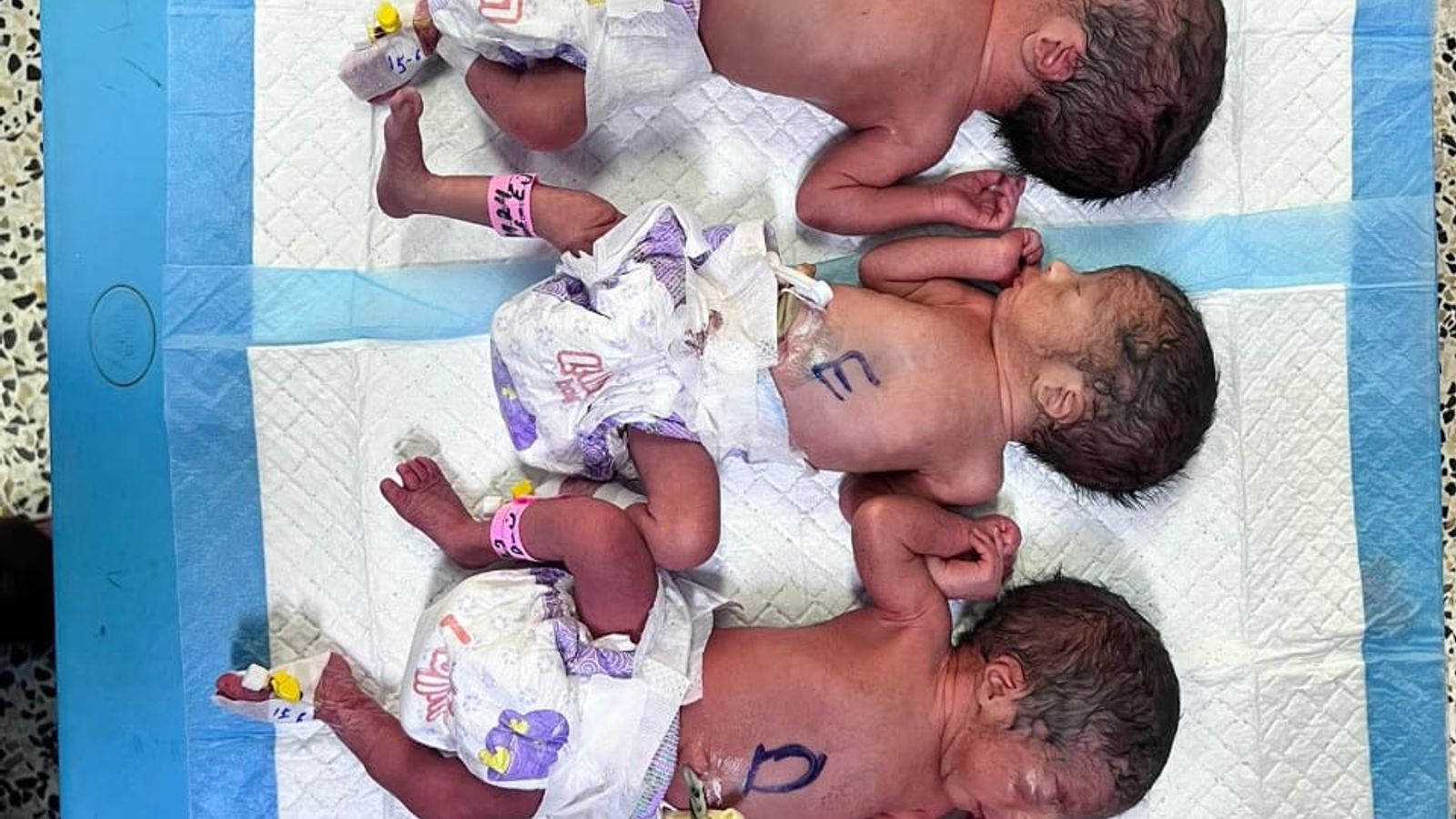 Mother Gives Birth to Quintuplets at Balkh Provincial Hospital