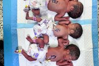 Mother Gives Birth to Quintuplets at Balkh Provincial Hospital