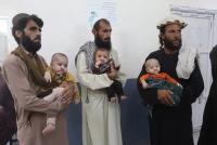 Free Surgical Treatment Planned for 250 Cleft Lip and Palate Patients in Khost