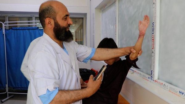 Paediatric surgeon in Kabul awarded for fish-skin burn treatment