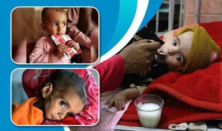 MSF Reports More Than 30 Percent Rise in Severe Child Malnutrition in Southern Afghanistan