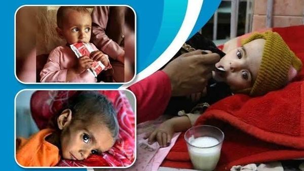 MSF Reports More Than 30 Percent Rise in Severe Child Malnutrition in Southern Afghanistan