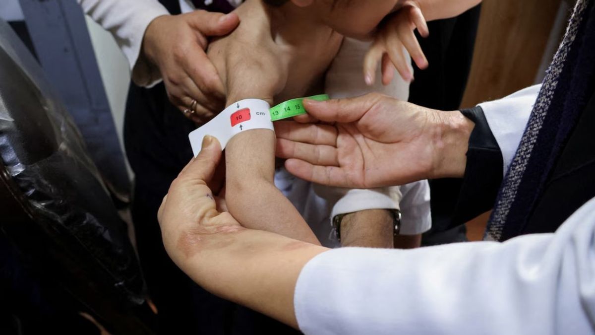 WFP Country Director Warns Lives of 4 Million Afghan Children at Risk from Malnutrition