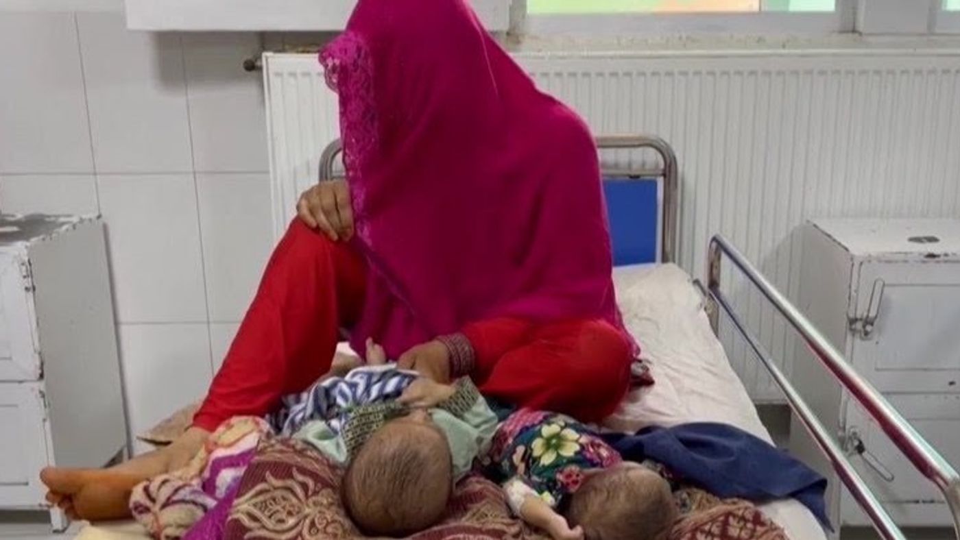 UN Official Warns Taliban Restrictions Worsen Maternal Mortality in Afghanistan