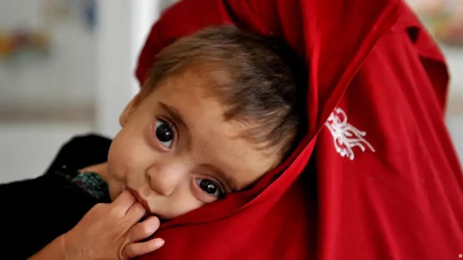 UNICEF Warns That Climate Change Is Increasing Child Malnutrition Risks in Afghanistan