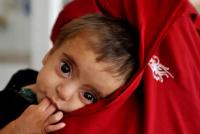 UNICEF Warns That Climate Change Is Increasing Child Malnutrition Risks in Afghanistan