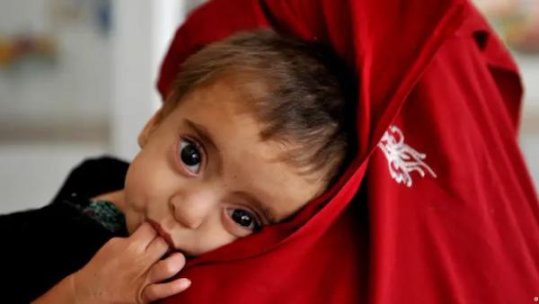 UNICEF Warns That Climate Change Is Increasing Child Malnutrition Risks in Afghanistan