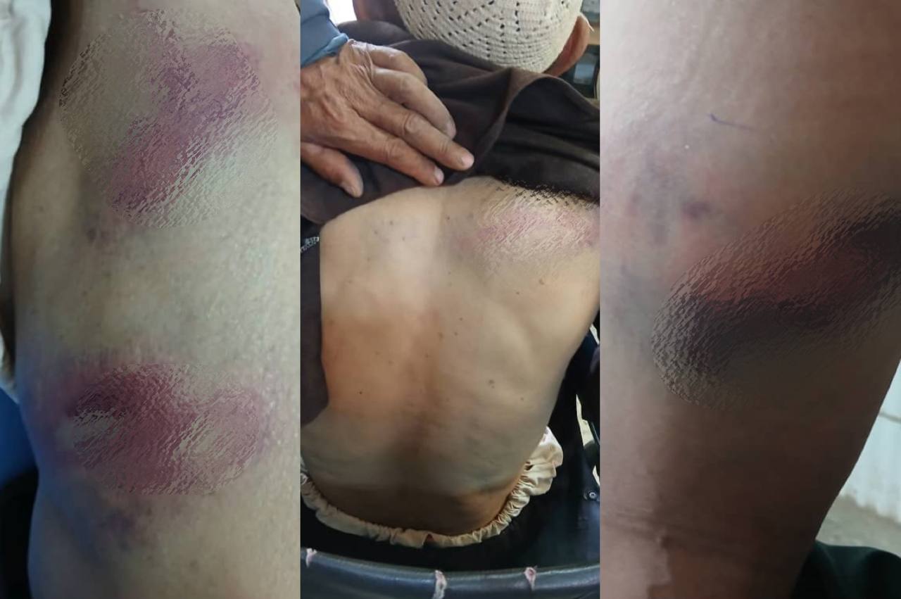 Three Injured in Clashes Between Nomads and Villagers in Bamyan