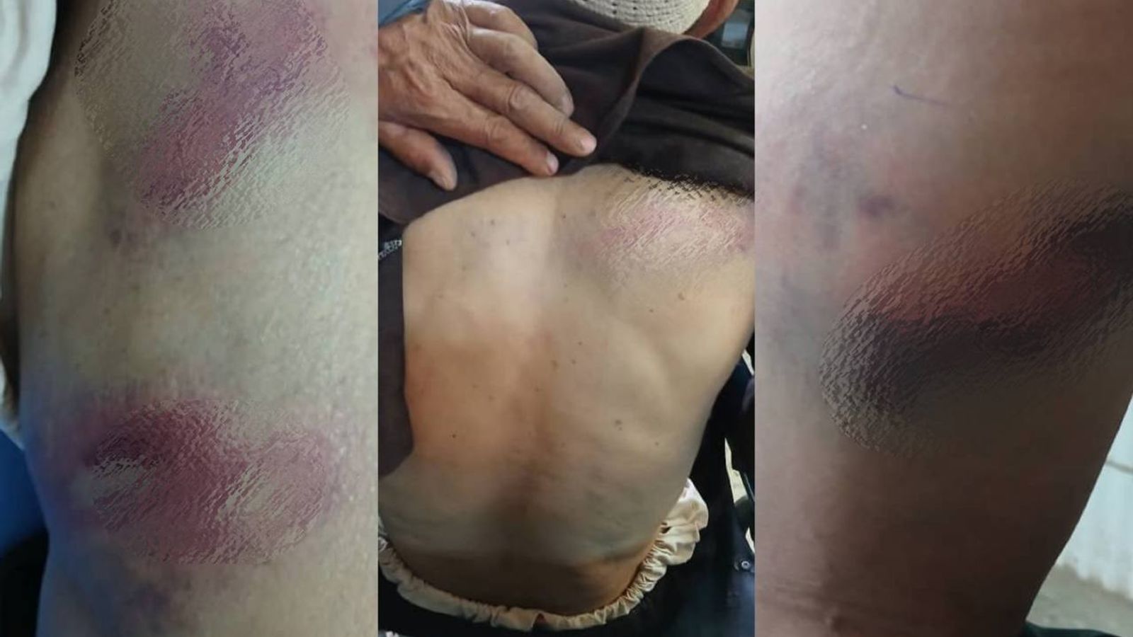 Three Injured in Clashes Between Nomads and Villagers in Bamyan