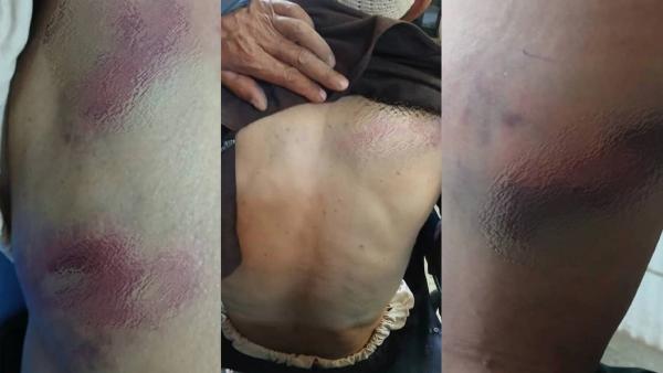 Three Injured in Clashes Between Nomads and Villagers in Bamyan