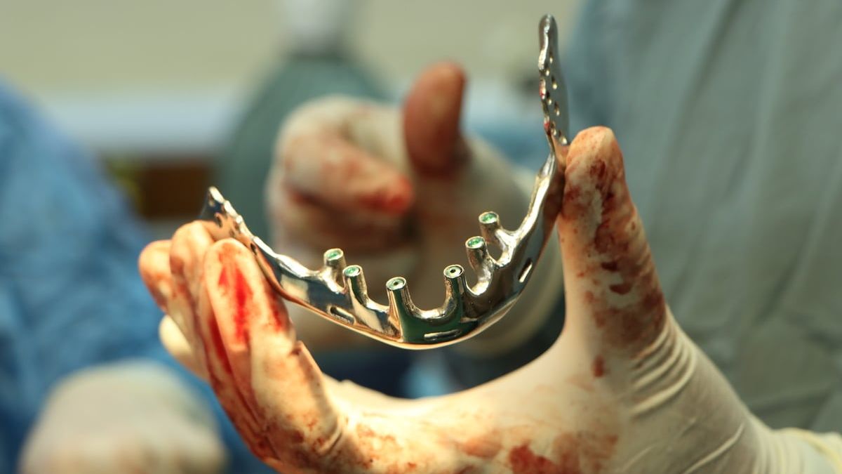 Dawood Khan Hospital Performs First Successful Lower Jaw Reconstruction Using Custom Implant