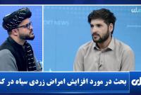 Health Officials and Experts Discuss Rise in Black Jaundice Cases in Afghanistan