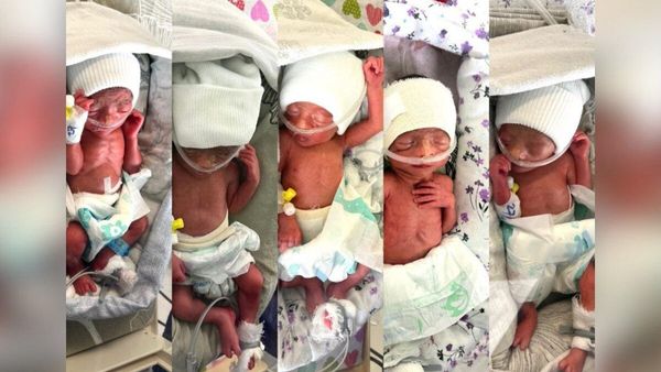 Afghan Woman Gives Birth to Quintuplets at Emergency Hospital