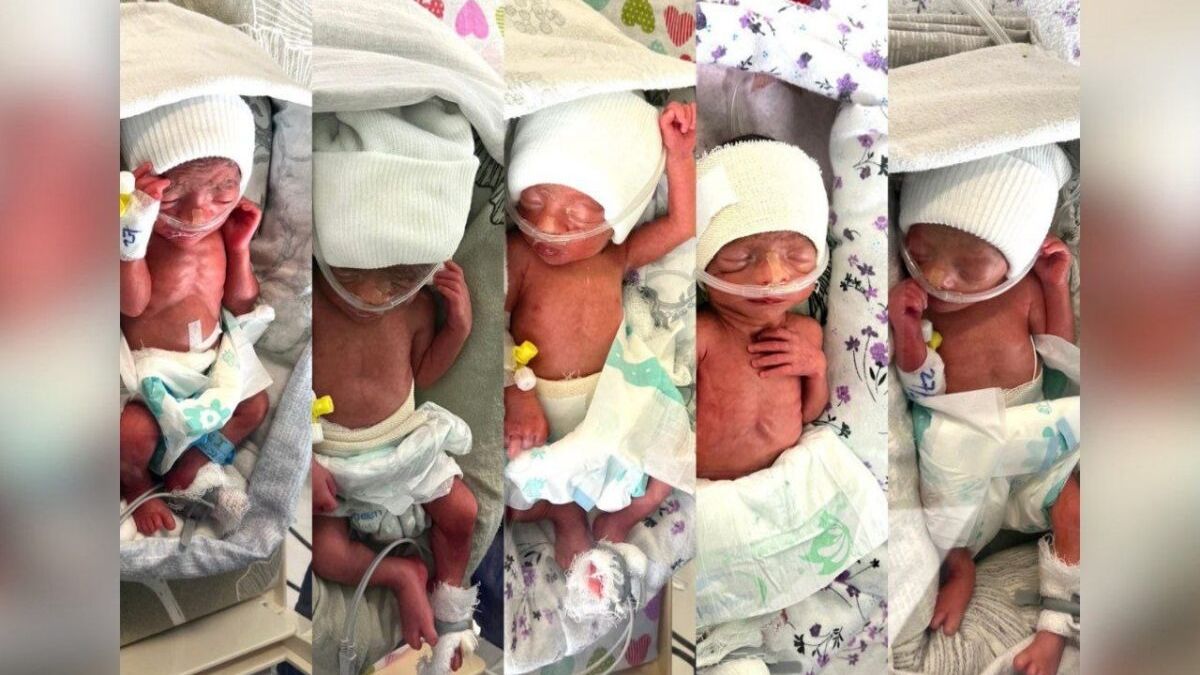 Afghan Woman Gives Birth to Quintuplets at Emergency Hospital