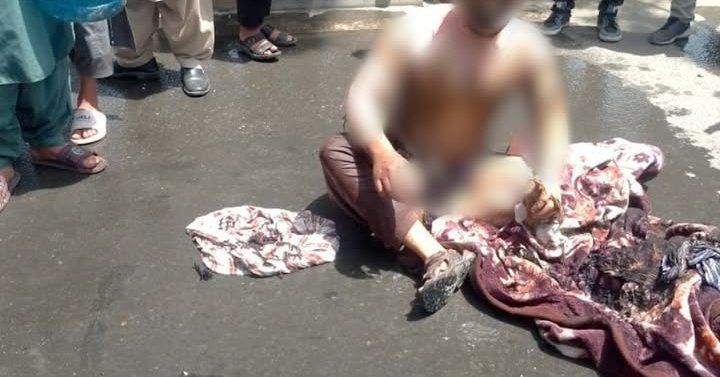 Engineer Dies Following Self-Immolation in Kabul Due to Economic Hardship