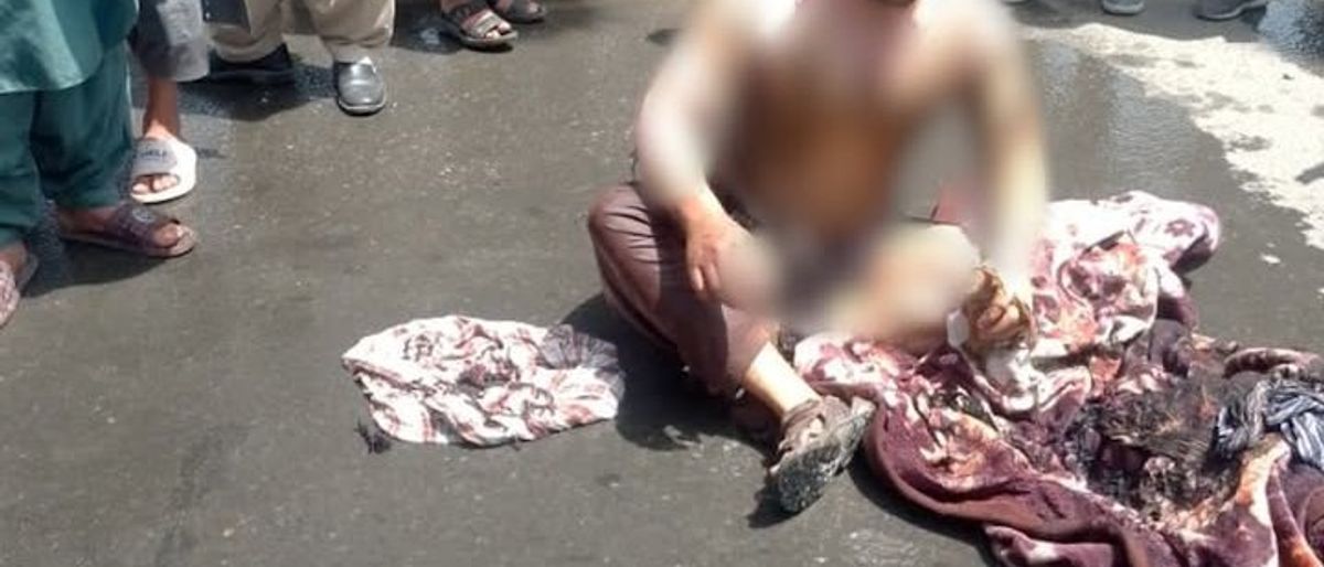 Engineer Dies Following Self-Immolation in Kabul Due to Economic Hardship
