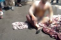 Engineer Dies Following Self-Immolation in Kabul Due to Economic Hardship