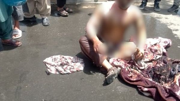 Engineer Dies Following Self-Immolation in Kabul Due to Economic Hardship