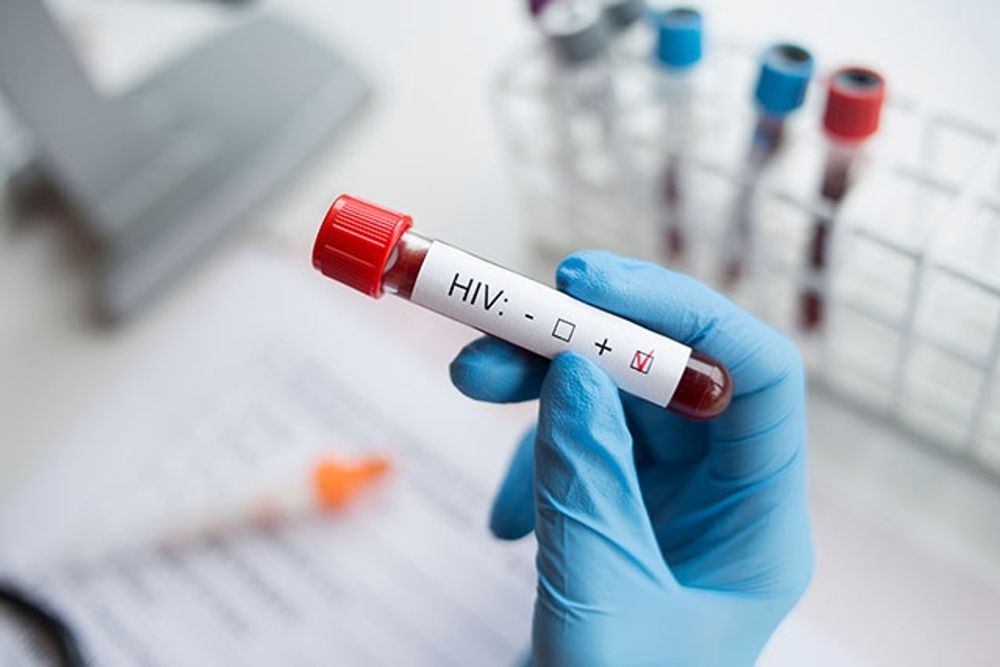 Ett fall i Barcelona kan bli banbrytande i behandlingen av HIV.