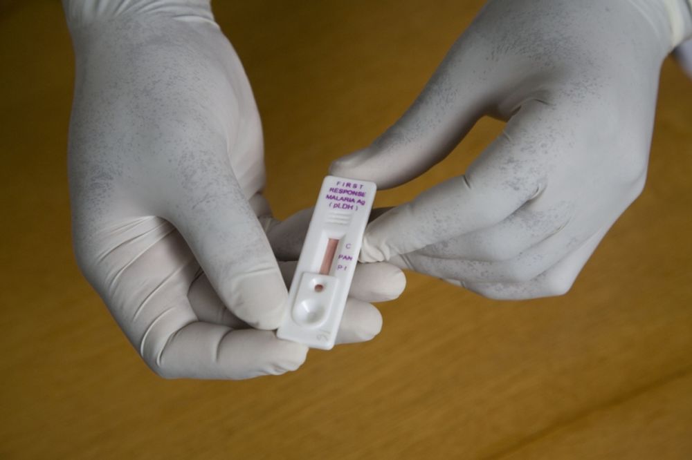 Prover som skickats till laboratorium i Madrid har fastst&auml;llt malaria. Foto: Gates Foundation