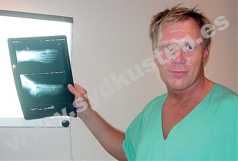 Danske &ouml;verl&auml;karen Allan Larsen arbetar sedan innan i somras p&aring; Marbella High Care International Hospital. Hans specialitet &auml;r brosktransplantationer, som han genomf&ouml;r &ouml;ver tusen per &aring;r i Danmark.