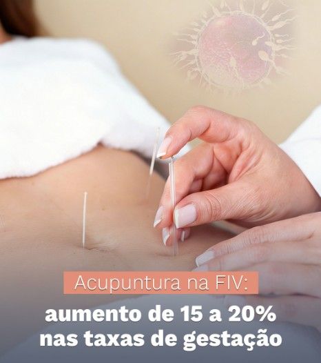 Acupuntura e Fertilidade em Moema: Como o Protocolo de Paulus Aumenta as Taxas de Gestação na FIV
