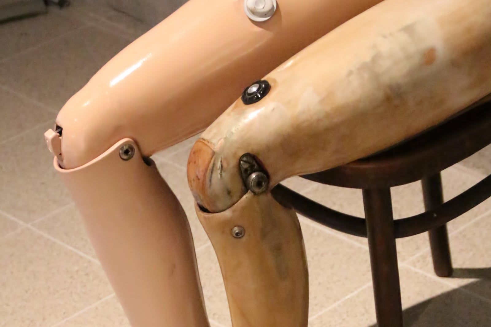 Cooperative Orthotic and Prosthetic Enterprise in Vientiane