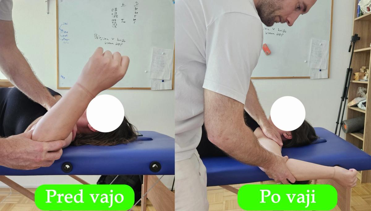 Izboljšanje zunanje rotacije v rami