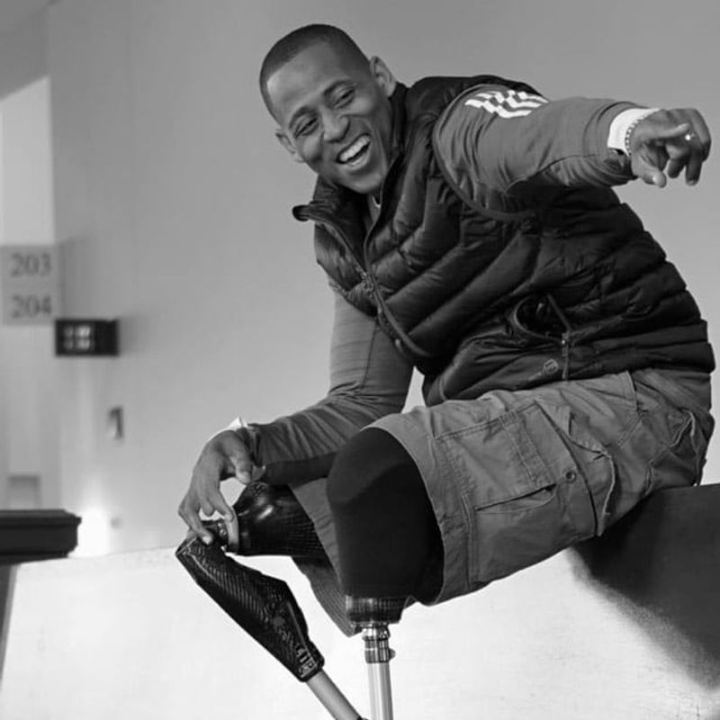 The gift of growth image of man with artificial legs smiling