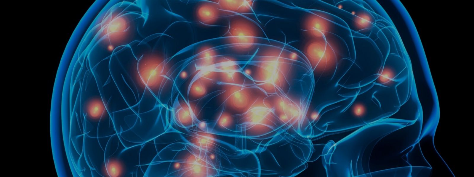 Is your brain healthy? Computer generated image of a human brain with red lights