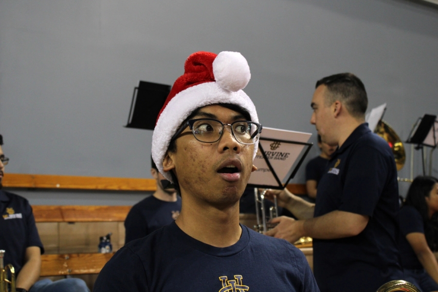 Boy wearing Santa hat looking surprised.