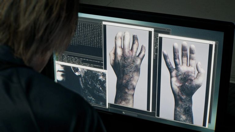Resident Evil Requiem: A person views images of discolored hands on a computer monitor.